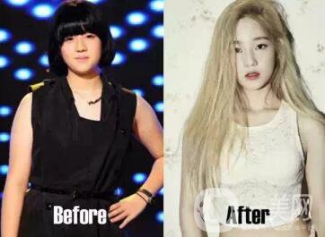 韓式共振吸脂減肥