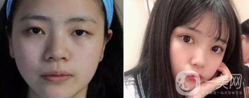 蔣小花醫(yī)生