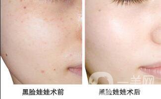 黑臉娃娃一般多少錢