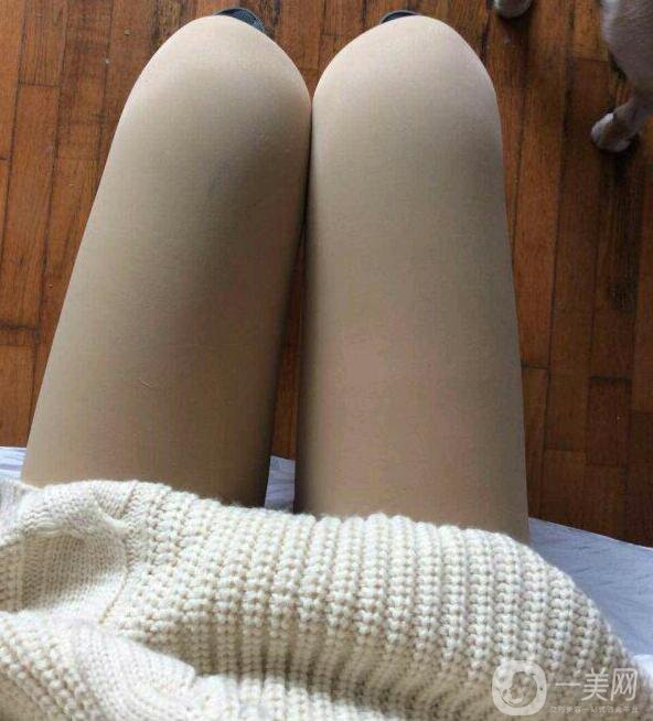 水動(dòng)力吸脂親身經(jīng)歷