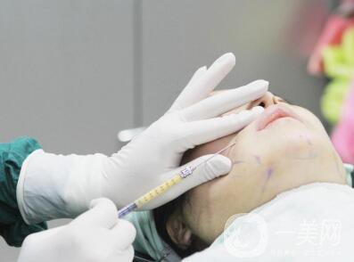 自體脂肪移植注意事項(xiàng)