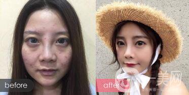 光電美容項(xiàng)目