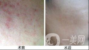 復合彩光調(diào)節(jié)