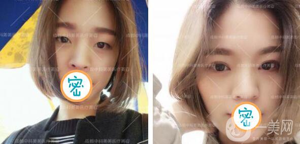 成都中科美美整形美容2019全新價格表