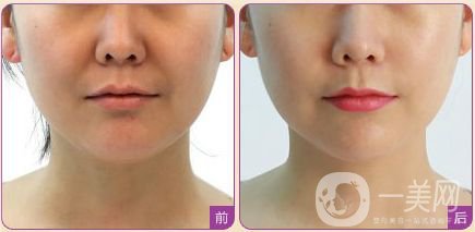 熱瑪吉多少錢呢