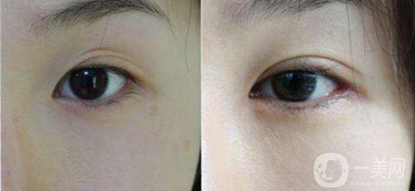 贛榆?chē)?guó)泰整形醫(yī)院