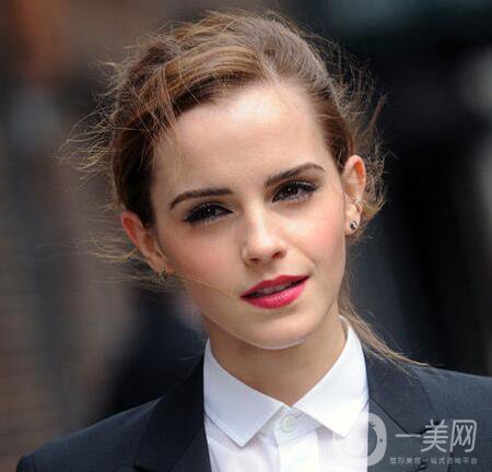 雙眼皮手術(shù)*多能修復(fù)幾次