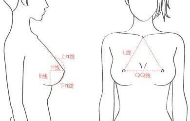 假體隆胸術有哪些特點？