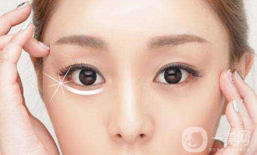 激光去眼袋的價(jià)格多少？要打幾次？