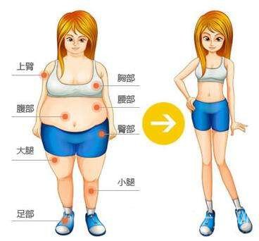 全身吸脂減肥好多錢？手術(shù)價格多少？