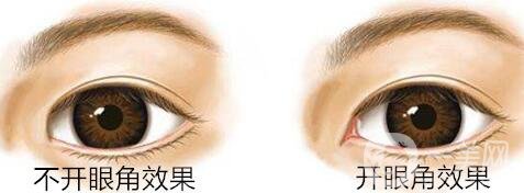 開眼角價(jià)位