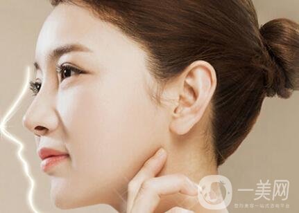 隆鼻后怎么消腫