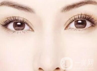 拉線雙眼皮貼的危害，小心你的眼皮變松弛!