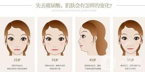 注射玻尿酸危害大嗎?有沒有毀容的風險?