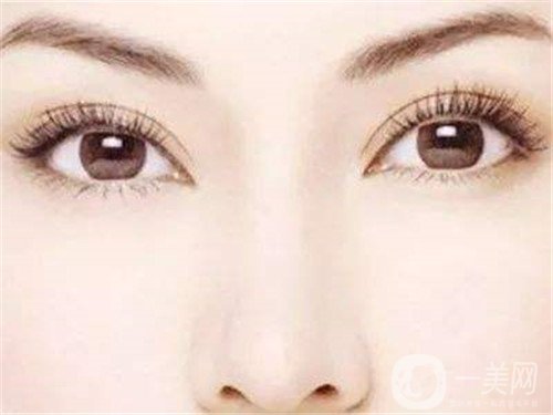 假體隆鼻多久完全消腫？怎么加速消腫呢？