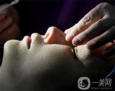 硅膠隆鼻能保持多久？可以終身保持嗎？