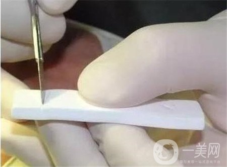 膨體隆鼻術(shù)后注意事項有哪些？需要忌口嗎？