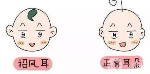 招風耳整形多少歲做比較合適?