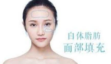 自體脂肪填充多久補(bǔ)打