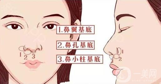 在韓國做鼻子要多少錢?比國內(nèi)的貴嗎?