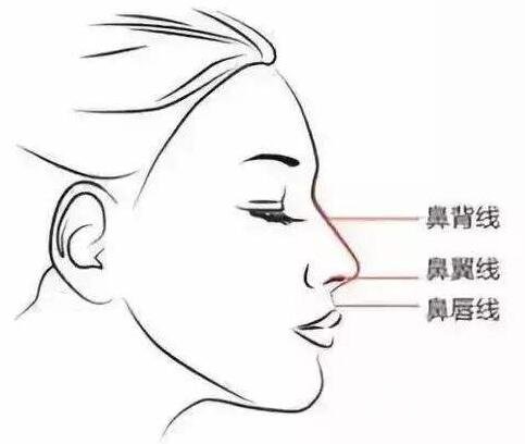 硅膠隆鼻一定會(huì)下滑嗎?下滑了怎么辦?