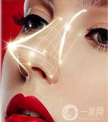 鼻部整形費用大概需要多少錢?包括哪些項目?