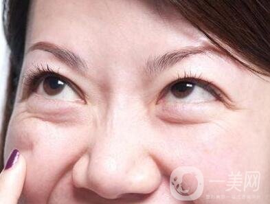 光乳化祛眼袋靠譜不?能什么樣的*果?