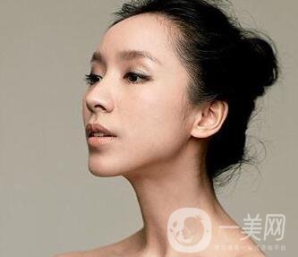 請(qǐng)問假體隆鼻手術(shù)需要多少錢呢？