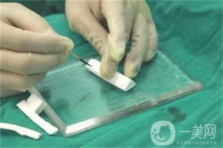 假體隆鼻術(shù)價格大概是多少？求告知