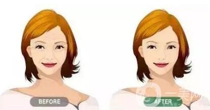 午間除皺到底是真是假?當(dāng)真有那么快?