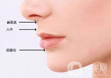 下巴突出怎么整？矯正手術(shù)原來是這么做的