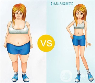 腰腹吸脂有積液怎么辦？不排出對身體有影響嗎？