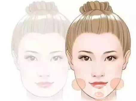 注射玻尿酸是整容嗎?能帶來(lái)哪些變化?