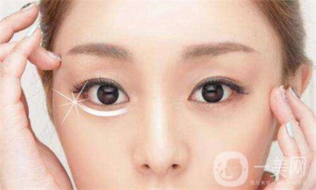 眼部提升手術(shù)怎么做？多久恢復(fù)？