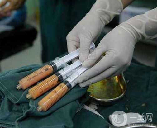 腰部吸脂的費(fèi)用大概多少錢？術(shù)后真的能瘦嗎？