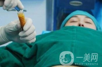 抽脂隆胸手術(shù)費用貴嗎？多少錢？