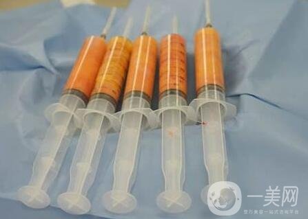 自體脂肪填充會(huì)留疤痕嗎?要注意些什么?