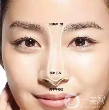 隆鼻手術(shù)怎么做？操作過程解析