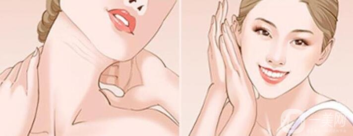 如何消除頸紋讓頸部變得緊實?