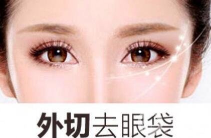 外切去眼袋后恢復(fù)期應(yīng)該注意什么?