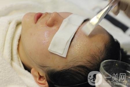 光子嫩膚價格多少？貴嗎？