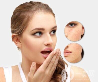 激光嫩膚價(jià)格一般是多少？*果好不好？