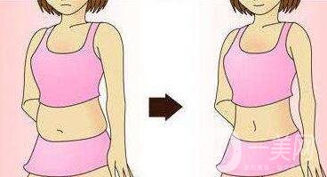 腹壁整形多少錢？費用詳細解說