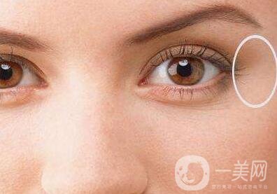 開眼角好嗎？*果怎么樣？