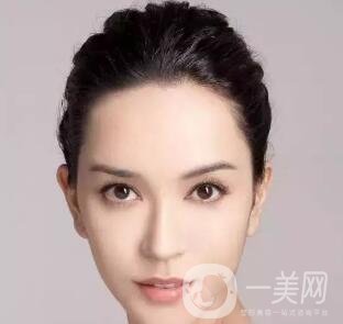 隆鼻手術(shù)的風(fēng)險(xiǎn)大嗎？有哪些？