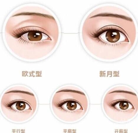 吸雕雙眼皮手術(shù)過程介紹和注意事項一覽