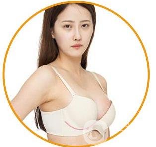 娜綺麗假體隆胸后多久可以變軟？