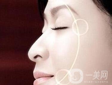 大拉皮除皺恢復(fù)時(shí)間要多久?可以做第二次嗎?