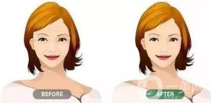 提升除皺手術(shù)多少錢(qián)?價(jià)格會(huì)有變化嗎