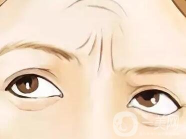 提升除皺手術(shù)多少錢(qián)?價(jià)格會(huì)有變化嗎